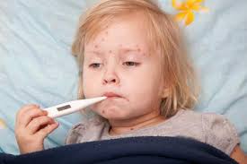 Bổ sung tiêm vắc xin sởi miễn phí cho trẻ từ 2-10 tuổi 1